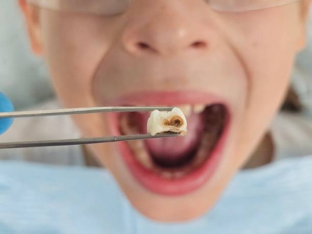 Best Dentist for Dental Trauma  in Arlington, WA